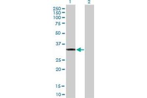 Western Blot analysis of CBR3 expression in transfected 293T cell line by CBR3 MaxPab polyclonal antibody. (CBR3 Antikörper  (AA 1-277))