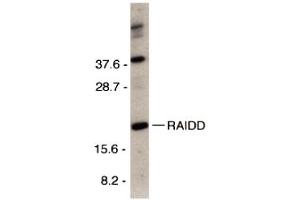 Western Blotting (WB) image for anti-CASP2 and RIPK1 Domain Containing Adaptor with Death Domain (CRADD) (C-Term) antibody (ABIN1030612)
