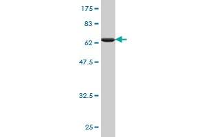 Western Blot detection against Immunogen (65. (PCBP2 Antikörper  (AA 1-362))