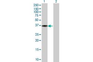 Western Blot analysis of DFNA5 expression in transfected 293T cell line ( H00001687-T01 ) by DFNA5 MaxPab polyclonal antibody. (DFNA5 Antikörper  (AA 1-295))