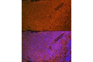 Immunofluorescence analysis of rat spleen using SHIP11 Rabbit mAb (ABIN7267882) at dilution of 1:100 (40x lens). (INPP5D Antikörper)
