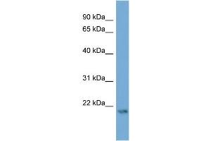 WB Suggested Anti-ATG12  Antibody Titration: 0. (ATG12 Antikörper  (Middle Region))