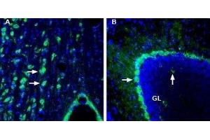 Expression of DP2 receptor (CRTH2/GPR44) in rat medial septum and mouse cerebellum - Immunohistochemical staining of perfusion-fixed frozen rat and mouse brain sections with Anti-CRTH2/GPR44 (extracellular) Antibody (ABIN7043564, ABIN7045118 and ABIN7045119), (1:200), followed by goat-anti-rabbit-AlexaFluor-488. (Prostaglandin D2 Receptor 2 (PTGDR2) (AA 270-283), (Extracellular) Antikörper)