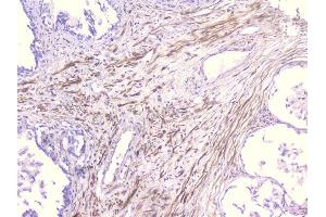 IHC analysis of PCDH15 using anti-PCDH15 antibody (ABIN6719362).