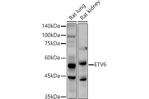 Western blot analysis of extracts of various cell lines, using ETV6 antibody (ABIN3022302, ABIN3022303, ABIN3022304, ABIN1512878 and ABIN6218719) at 1:1000 dilution. (ETV6 Antikörper  (AA 1-300))