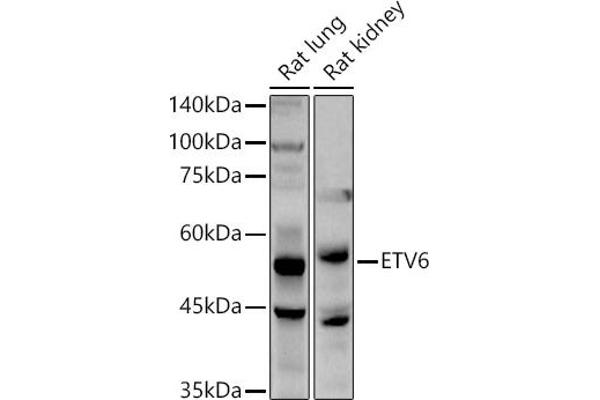ETV6 Antikörper  (AA 1-300)