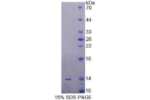 SDS-PAGE analysis of Human SRP9 Protein. (SRP9 Protein)