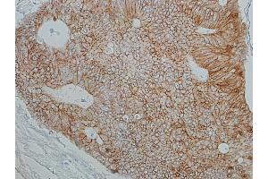 Immunohistochemistry (IHC) image for anti-Catenin, beta (CATNB) (AA 725-775) antibody (ABIN7455205) (Rekombinanter beta Catenin Antikörper  (AA 725-775))