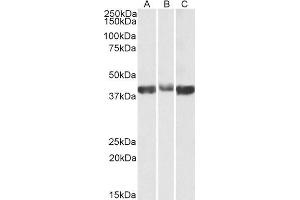 ABIN2613377 (0. (ALDOA Antikörper  (AA 86-96))