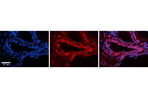 Rabbit Anti-TSHR Antibody   Formalin Fixed Paraffin Embedded Tissue: Human Thyroid Tissue Observed Staining: Plasma membrane and cytoplasm in follicular cells Primary Antibody Concentration: 1:100 Other Working Concentrations: N/A Secondary Antibody: Donkey anti-Rabbit-Cy3 Secondary Antibody Concentration: 1:200 Magnification: 20X Exposure Time: 0. (TSH receptor Antikörper  (N-Term))