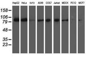 Image no. 2 for anti-Excision Repair Cross-Complementing Rodent Repair Deficiency, Complementation Group 4 (ERCC4) antibody (ABIN1498071) (ERCC4 Antikörper)