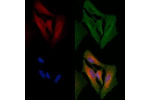 ABIN6264983 and ABIN6266656 staining  cells by IF/ICC. (SENP1 Antikörper  (N-Term))