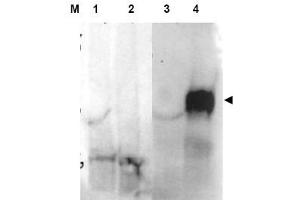 Image no. 1 for anti-Fibroblast Activation Protein, alpha (FAP) (Internal Region) antibody (ABIN401429) (FAP Antikörper  (Internal Region))