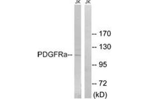 Western blot analysis of extracts from Jurkat cells, using PDGFRa (Ab-849) Antibody. (PDGFRA Antikörper  (AA 816-865))