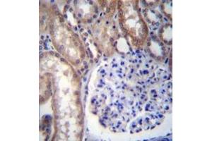 Immunohistochemistry (Paraffin-embedded Sections) (IHC (p)) image for anti-Guanine Nucleotide Binding Protein (G Protein), alpha 14 (GNa14) (AA 11-41), (N-Term) antibody (ABIN952412)