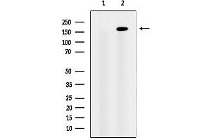 Western blot analysis of lysates from HEK-293 cells, using CEP164 Antibody. (CEP164 Antikörper  (C-Term))