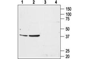 Western blot analysis of rat liver (lanes 1 and 3) and rat kidney (lanes 2 and 4) membranes: - 1,2. (Angiotensin II Type-1 Receptor Antikörper  (Extracellular, N-Term))