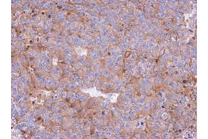 IHC-P Image Immunohistochemical analysis of paraffin-embedded PC13 xenograft, using Calpain 1, antibody at 1:500 dilution. (CAPN1 Antikörper)