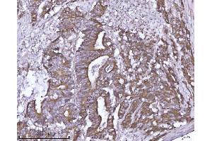 IHC analysis of ABP1/AOC1 using anti-ABP1/AOC1 antibody (ABIN7600040).