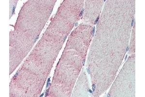 IHC testing of FFPE human skeletal muscle tissue with OSBPL1A antibody at 5ug/ml.