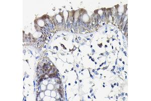 Immunohistochemistry of paraffin-embedded human colon using Galectin 3/Galectin 3/LG Rabbit pAb (ABIN7267338) at dilution of 1:100 (40x lens). (Galectin 3 Antikörper  (AA 1-250))