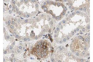 ABIN6272896 at 1/100 staining Mouse kidney tissue by IHC-P. (TIMM23 Antikörper  (N-Term))
