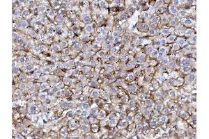 IHC analysis of EGFR using anti-EGFR antibody (ABIN7601478). (EGFR Antikörper  (AA 36-497))