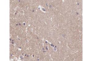 ABIN6266548 at 1/200 staining human brain tissue sections by IHC-P. (Metabotropic Glutamate Receptor 4 Antikörper  (C-Term))