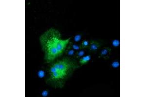 Anti-CLPP mouse monoclonal antibody (ABIN2453957) immunofluorescent staining of COS7 cells transiently transfected by pCMV6-ENTRY CLPP (RC200301). (CLPP Antikörper)