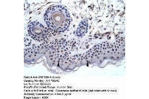 Human Skin (ZNF660 Antikörper  (C-Term))