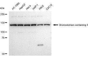 Western blotting analysis using Bromodomain containing 4 antibody (ABIN7797799).