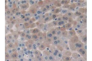 Immunohistochemistry (IHC) image for anti-Activin A Receptor, Type IIB (ACVR2B) (AA 214-350) antibody (ABIN1175515)