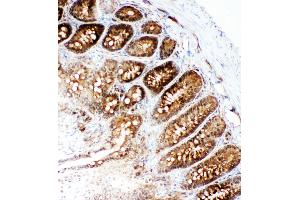 Immunohistochemistry (IHC) image for anti-Valosin Containing Protein (VCP) (AA 749-766), (C-Term) antibody (ABIN3043984)