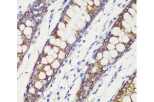 Immunohistochemistry of paraffin-embedded Human colon using TOM20 Polyclonal Antibody at dilution of 1:100 (40x lens). (TOMM20 Antikörper)