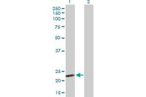 Western Blot analysis of BAG2 expression in transfected 293T cell line by BAG2 MaxPab polyclonal antibody. (BAG2 Antikörper  (AA 1-211))