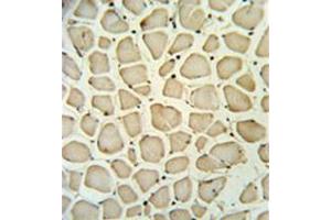 Immunohistochemistry analysis in formalin fixed and paraffin embedded skeletal muscle reacted with PGP Antibody (N-term) followed which was peroxidase conjugated to the secondary antibody and followed by DAB staining. (PGP Antikörper  (N-Term))