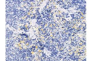 ABIN7094732 and ABIN7098783 at 1/100 staining Rat spleen tissue by IHC-P. (CD43 Antikörper  (Internal Region))