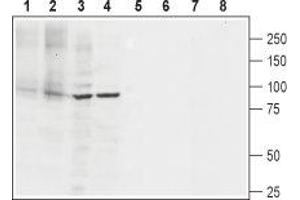Western blot analysis of rat heart membranes (lanes 1 and 5), mouse heart membranes (lanes 2 and 6), rat PC12 pheochromocytoma cell line lysate (lanes 3 and 7) and human Jurkat T cell leukemia cell line lysate (lanes 4 and 8): - 1-4. (ATP2A2 Antikörper  (2nd Cytoplasmic Loop))