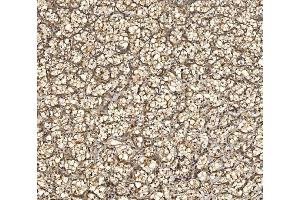 IHC analysis of EIF5 using anti-EIF5 antibody (ABIN7599722).