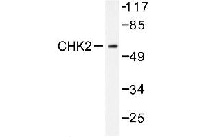 Image no. 1 for anti-Checkpoint Kinase 2 (CHEK2) (pSer379) antibody (ABIN272011) (CHEK2 Antikörper  (pSer379))