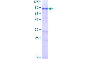 SMARCE1 Protein (AA 1-411) (GST tag)