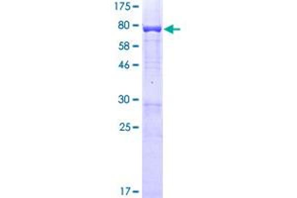 SMARCE1 Protein (AA 1-411) (GST tag)