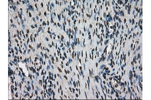 Immunohistochemical staining of paraffin-embedded colon tissue using anti-MKI67mouse monoclonal antibody. (Ki-67 Antikörper  (AA 1-250))