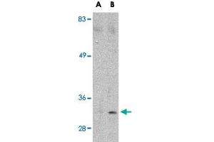 Western blot analysis of MARCH8 in HeLa cell lysate with MARCH8 polyclonal antibody  at (A) 0. (MARCH8 Antikörper  (C-Term))