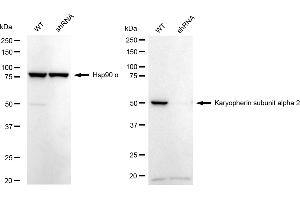 Western blotting analysis using karyopherin subunit alpha 2 antibody (ABIN7800945). (Rekombinanter Importin Subunit alpha-1 (KPNA2) Antikörper)