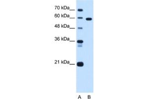 Western Blotting (WB) image for anti-T-Box 15 (TBX15) antibody (ABIN2463095) (T-Box 15 Antikörper)