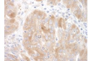 anti-SFRS Protein Kinase 2 (SRPK2) (AA 425-475) antibody