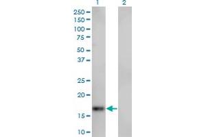 Western Blot analysis of SPIRE1 expression in transfected 293T cell line by SPIRE1 monoclonal antibody (M01), clone 4C5.