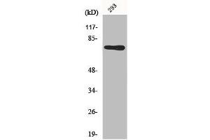 Western Blot analysis of 293 cells using Midline-1 Polyclonal Antibody (MID1 Antikörper  (N-Term))