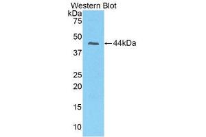 Western Blotting (WB) image for anti-Prolactin-Induced Protein (PIP) (AA 1-146) antibody (ABIN1860229)
